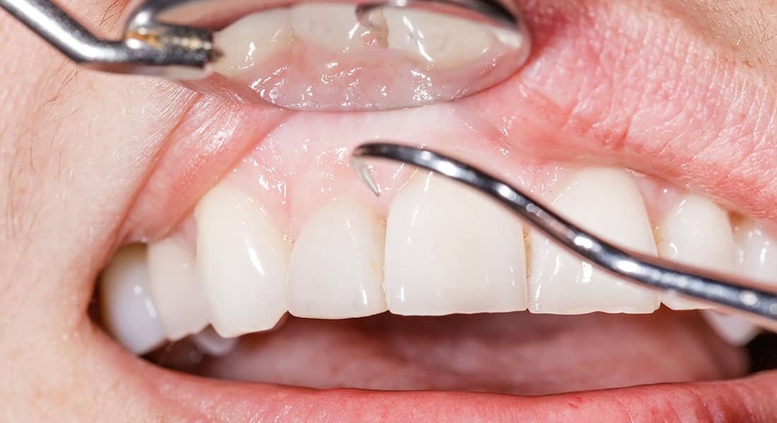 Periodontia